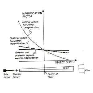 بد شکلی تصویر (Image distortion)