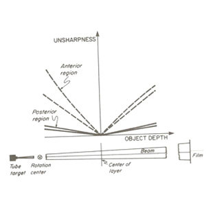 ناواضحی (unsharpness)