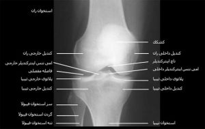 آناتومی زانو