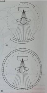 توموگرافی کامپیوتری