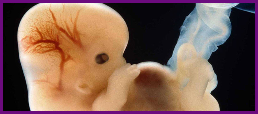 اثر اشعه بر روی جنین