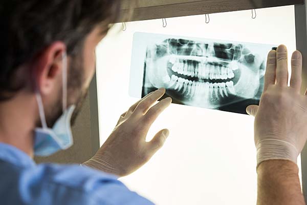 پوسیدگی دندان و اشعه ایکس