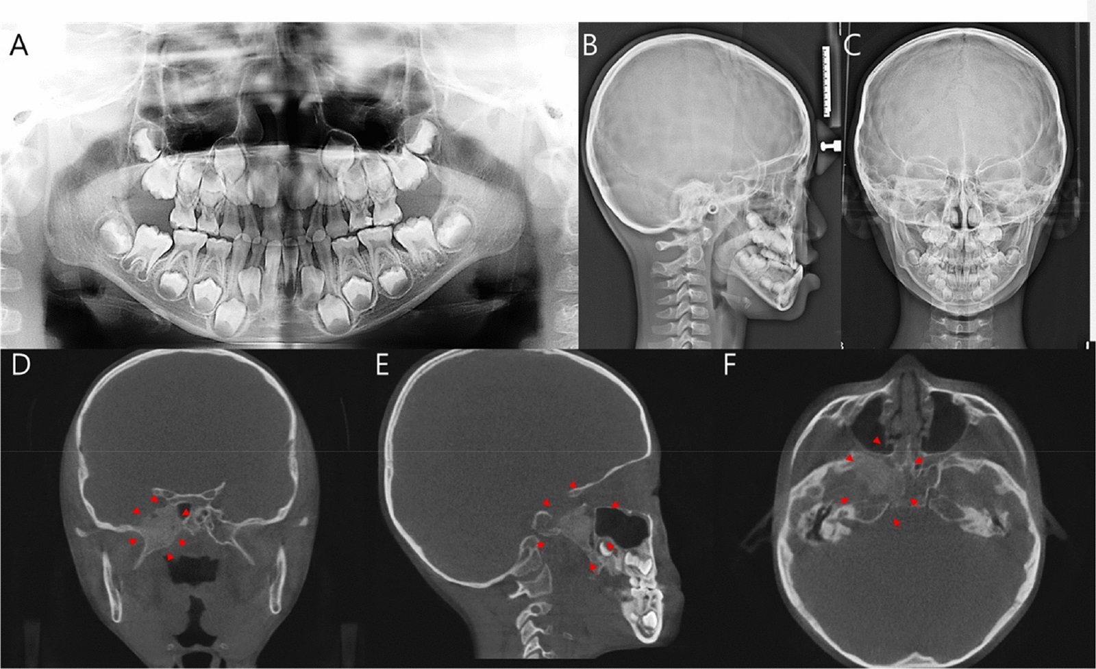 کاربردهای رایج CBCT دندان